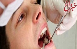 «لق شدن» دندان‌ها در بزرگسالی را جدی بگیرید!