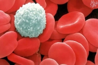 تشخیص زودهنگام و ارزان سرطان خون