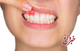 ویتامینی که کمبودش خون به پا می کند ویتامینی که کمبودش خون به پا می کند